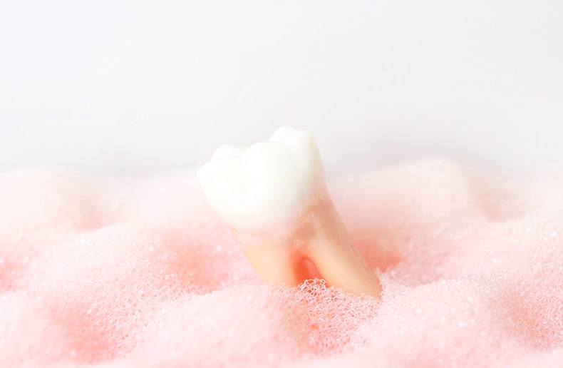 歯周病と歯槽膿漏の違いを知ろう！